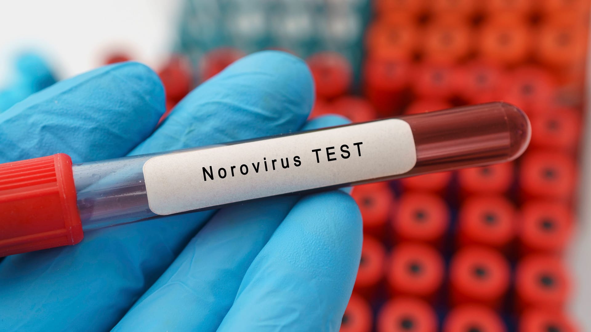 Eine Blutprobe wurde auf das Norovirus getestet (Symbolbild): In Köln steigen die Fälle der hochansteckenden Infektionskrankheit. Eine Blutprobe wurde auf das Norovirus getestet (Symbolbild): In Köln steigen die Fälle der hochansteckenden Infektionskrankheit.