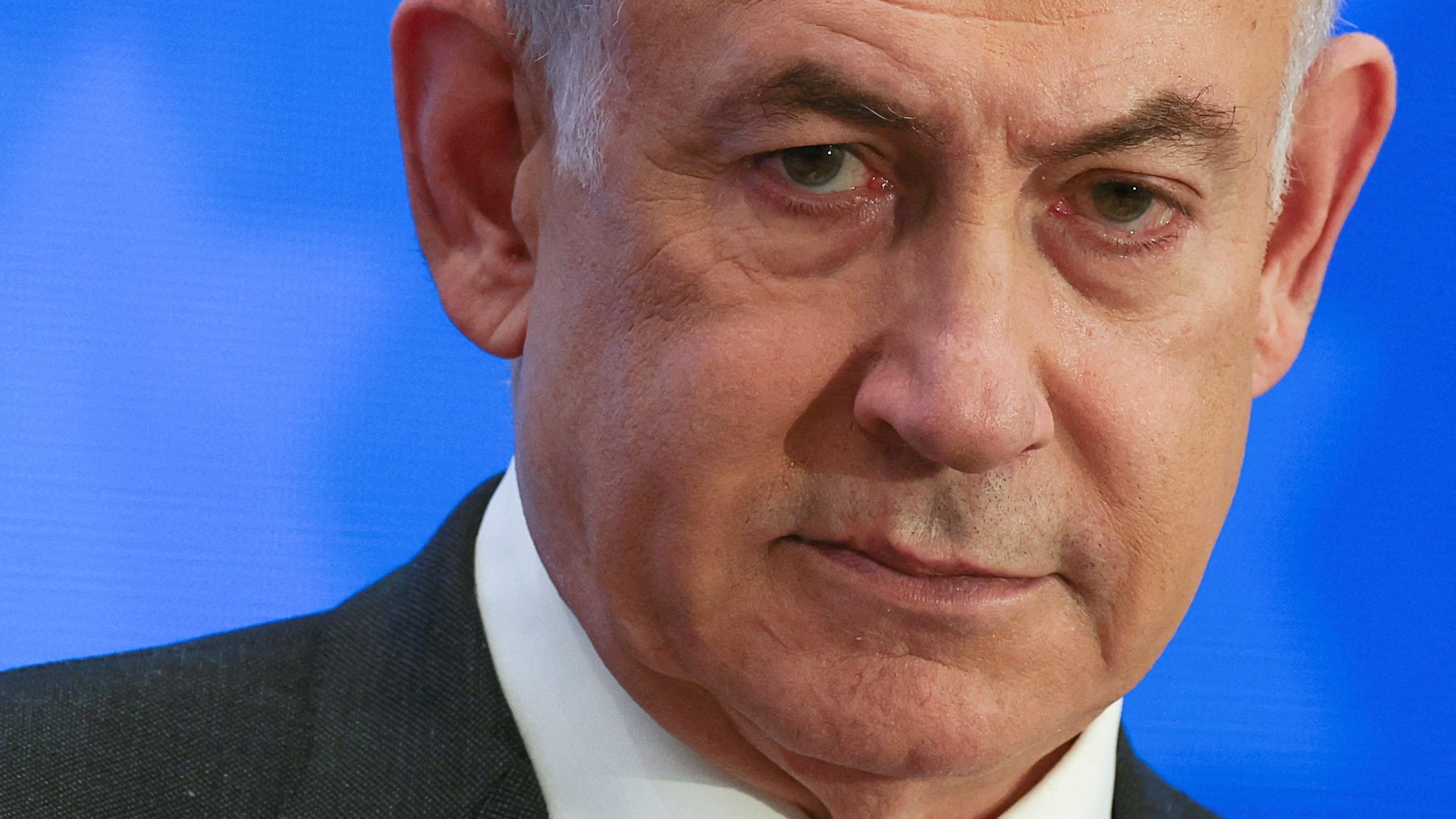 Israel: Benjamin Netanjahu unter Vollnarkose operiert