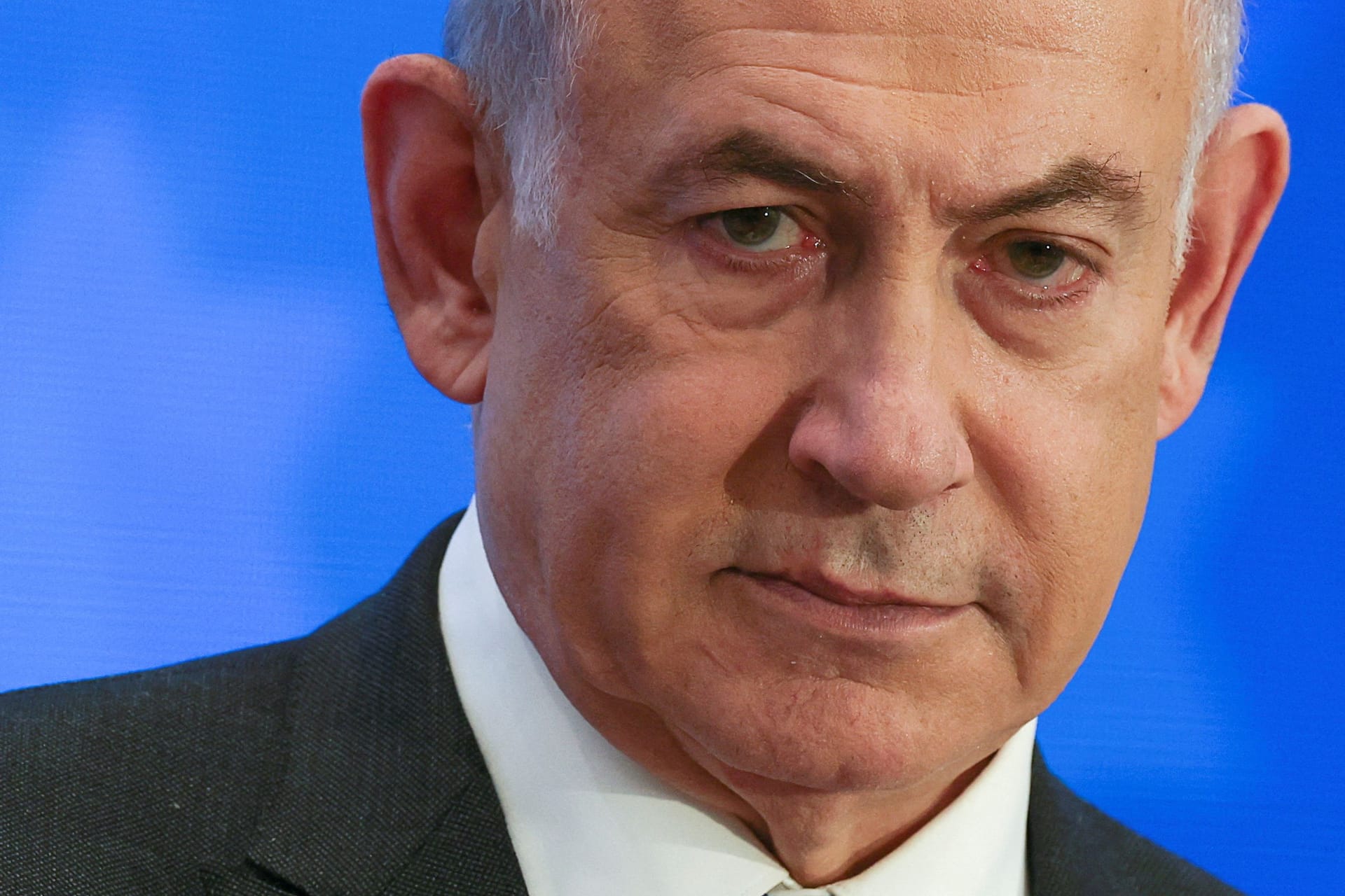 Gaza-Krieg, Geiselkrise, Proteste: Benjamin Netanjahu muss trotzdem unters Messer (Archivbild).