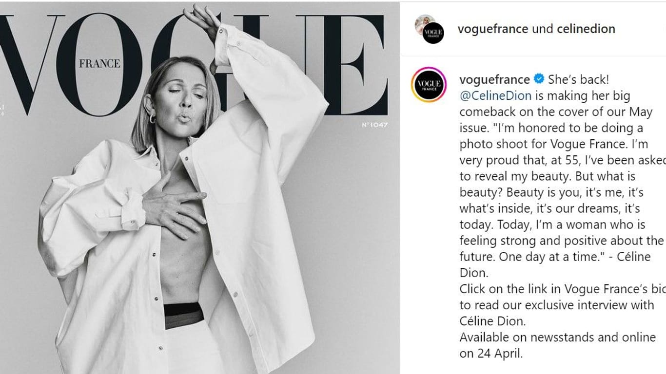 Die Sängerin zeigt sich auf dem Titel der neuen "Vogue" freizügig und lebenslustig.