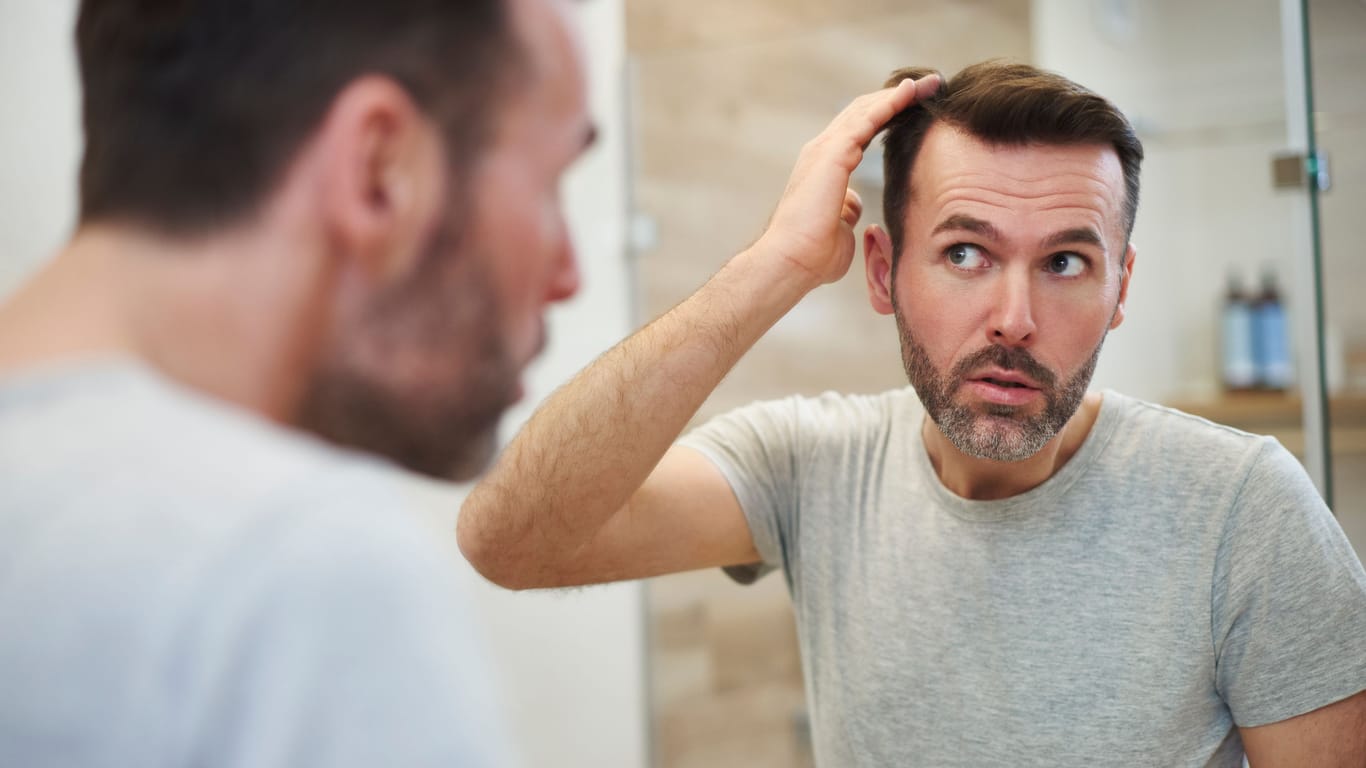 Nimmt der Haarausfall zu, frage sich viele Männer, welche Ausmaße er annehmen wird.