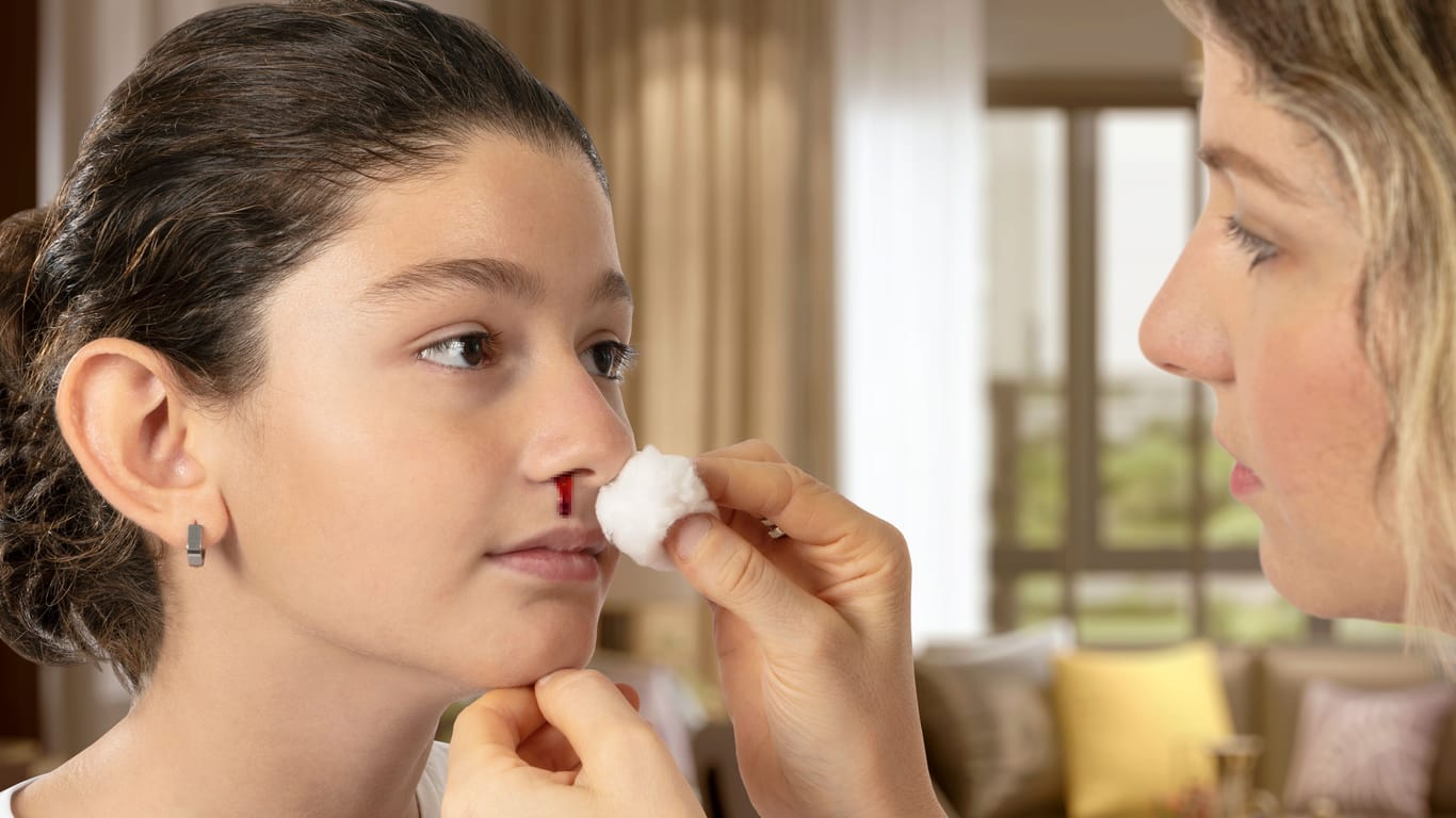 Mädchen mit Nasenbluten: Häufiges oder längeres Nasenbluten kann ein Hinweis auf das Von-Willebrand-Jürgens-Syndrom sein.