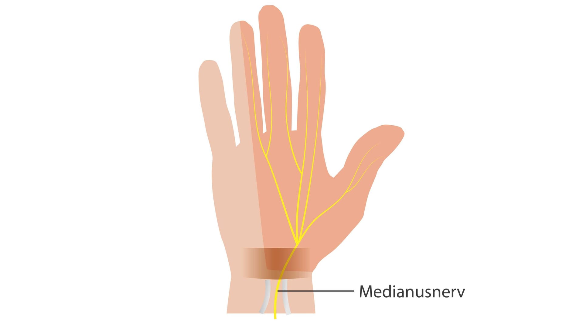 Grafik Medianusnerv: Mittig im Handgelenk verläuft im sogenannten Karpaltunnel der Medianusnerv.