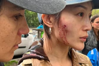 Die beiden Verletzten Cora (rechts) und Kim Ann Foxman (links): Die Attacke passierte mitten in Neukölln.
