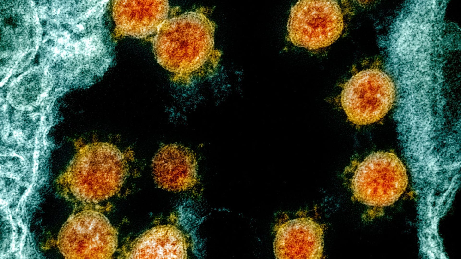 Coronavirus Coronavirus