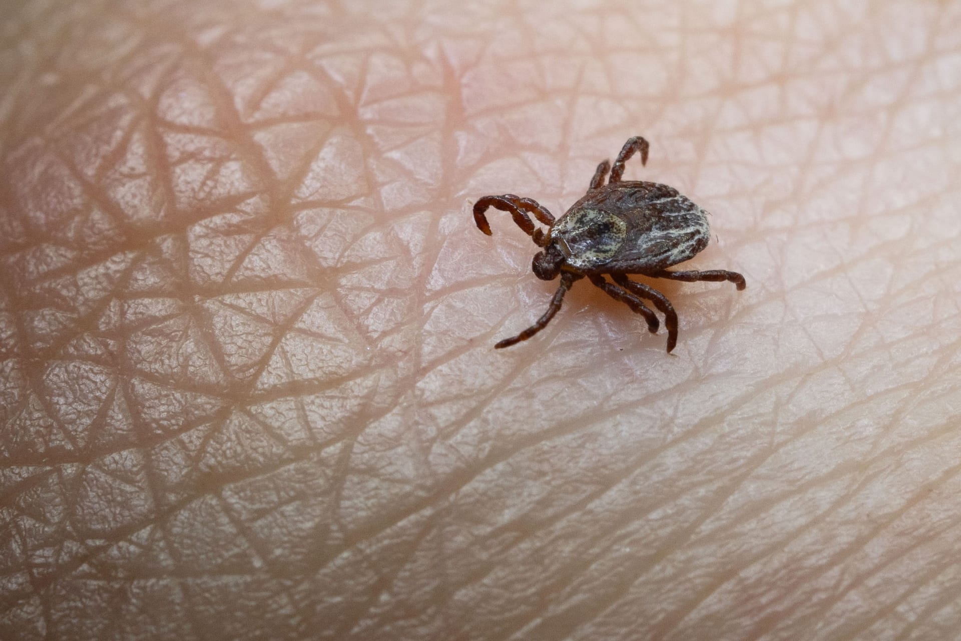 Zecken: Das FSME-Virus, mit dem sich Zecken infizieren, kann an den Menschen weitergeben werden.
