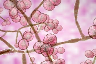 Pilzsporen des Candida auris: Er wird immer mehr zur Bedrohung