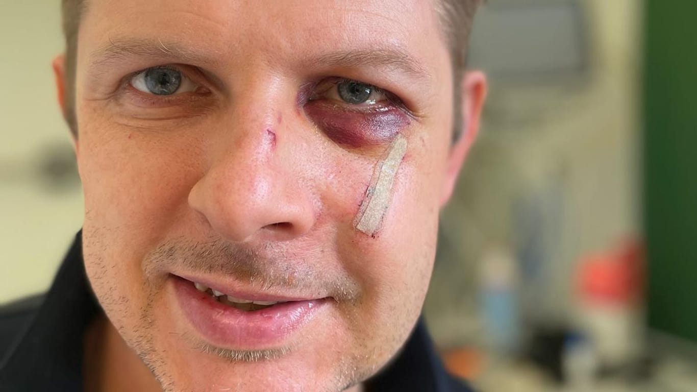 Der verletzte SPD-Europaabgeordnete Matthias Ecke meldete sich gestern per Selfie aus dem Krankenhaus.