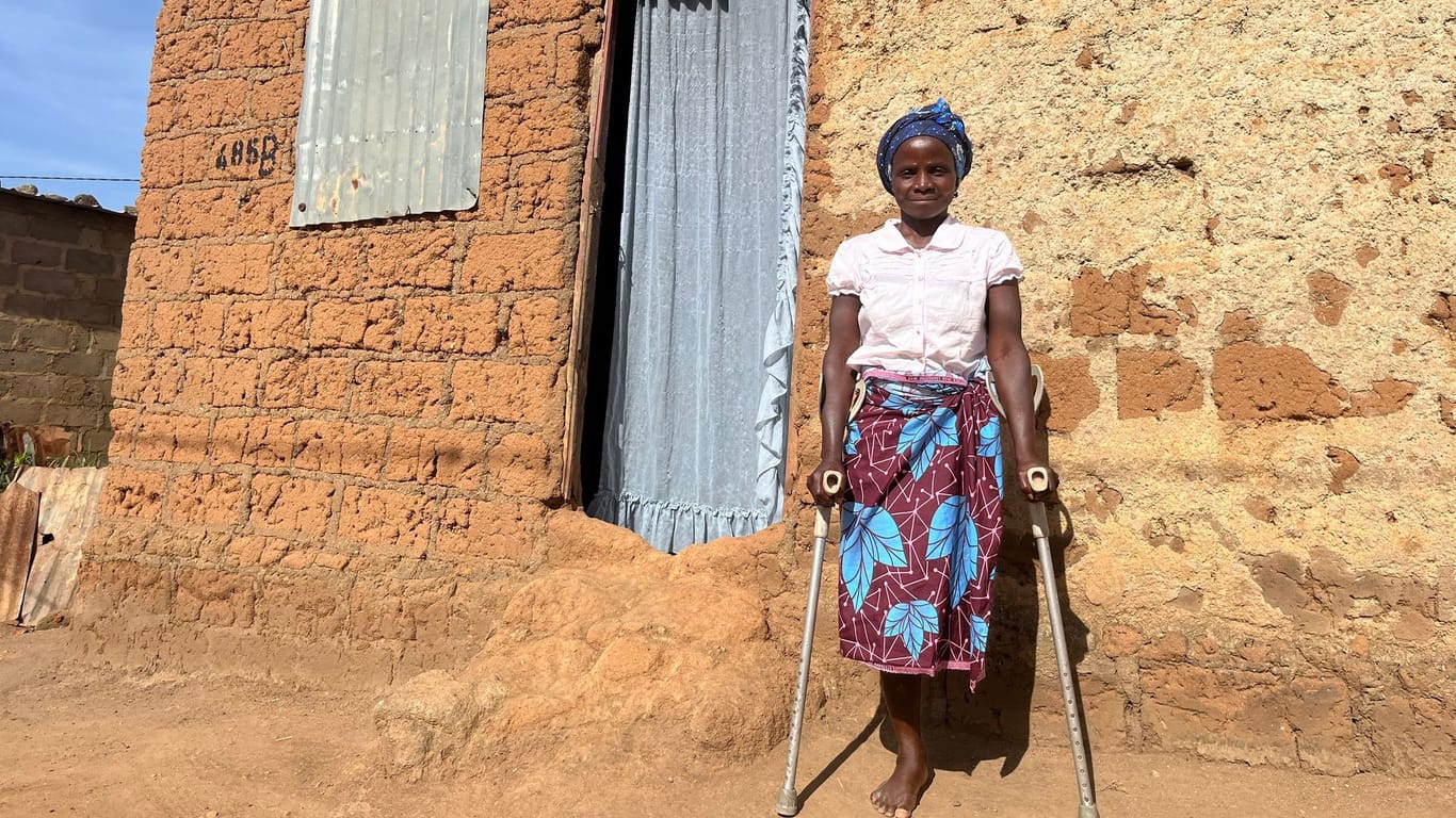 Die Kleinbäuerin Ana José Capagaio (37) steht vor ihrem Haus im Dorf Calulo in der angolanischen Provinz Kwanza Sul. Die alleinstehende Mutter von sieben Kindern trat bei der Suche nach Feuerholz auf eine Landmine und verlor ihr linkes Bein.
