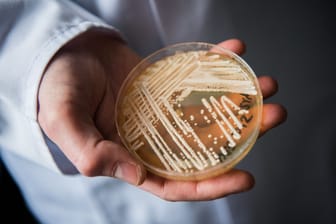 Eine Petrischale mit dem Hefepilz Candida auris (Symbolbild): Pilzerkrankungen können durch den Klimawandel begünstig werden.
