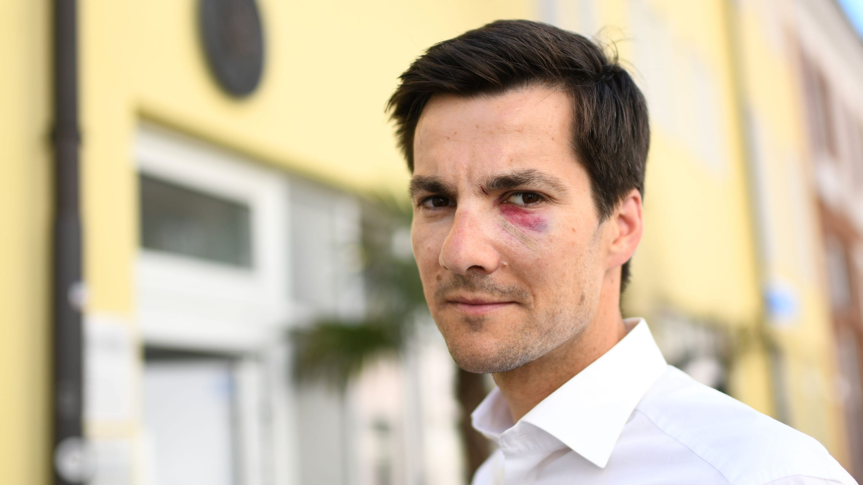 Gewalt gegen Politiker: Freiburgs Oberbürgermeister Martin Horn verprügelt