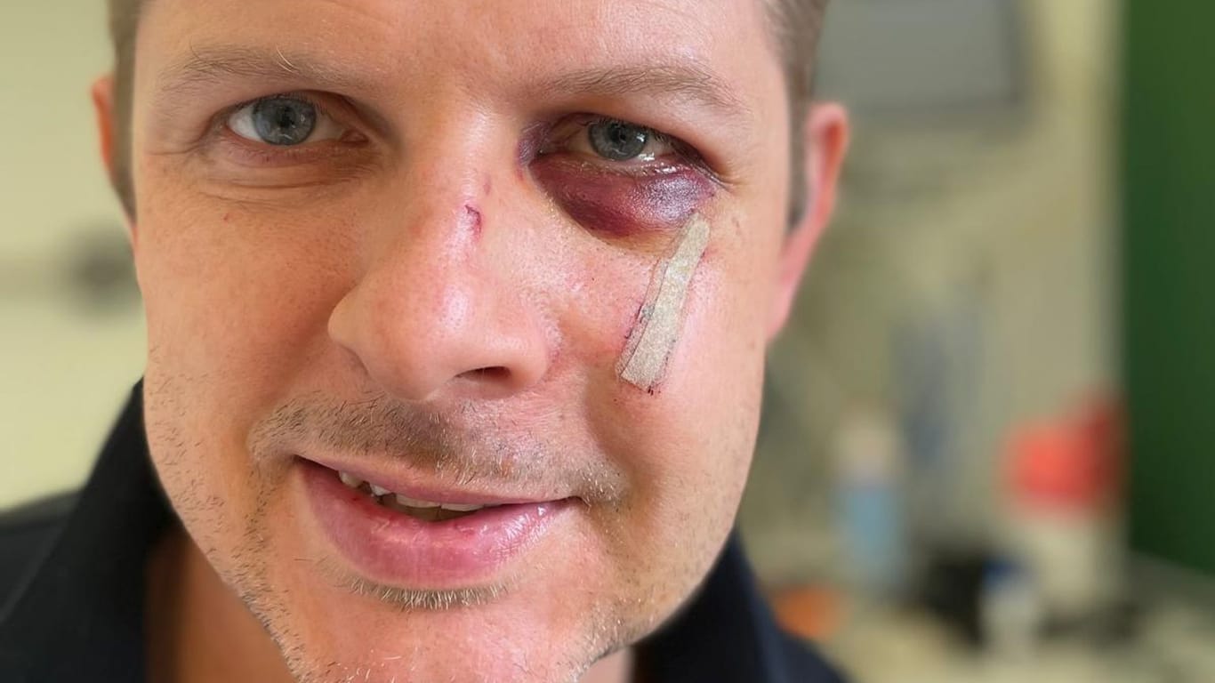 Ein Bild des angegriffenen Matthias Ecke aus dem Krankenhaus.