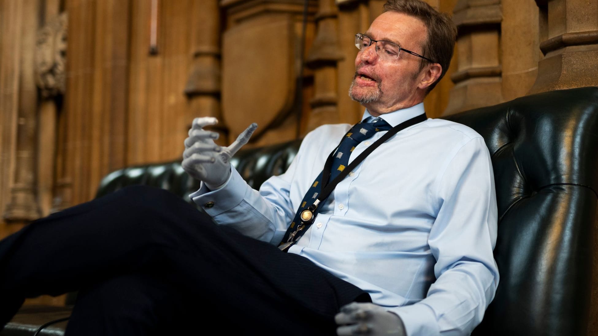 London: Britischer Abgeordneter nach Amputation von Händen und Beinen zurück