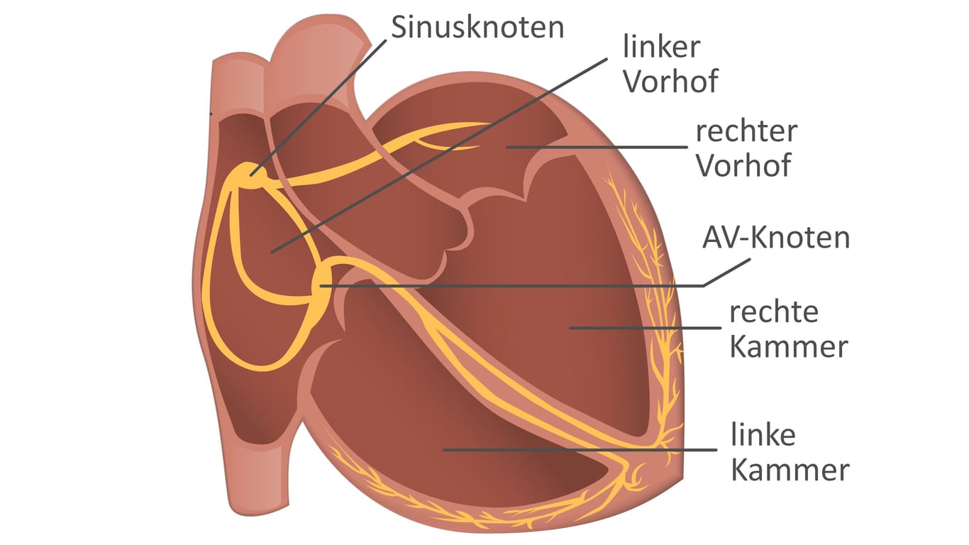 Grafische Darstellung des elektrischen Leitungssystems (gelb) im Herz