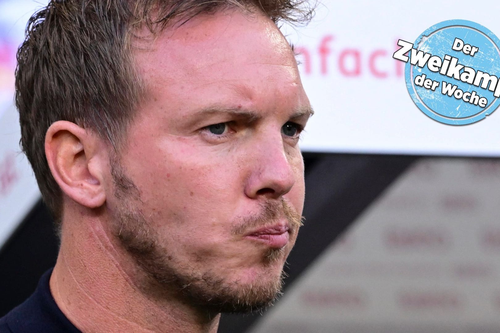 Zufrieden sieht anders aus: Julian Nagelsmann beim letzten Testspiel vor dem EM-Start gegen Griechenland.