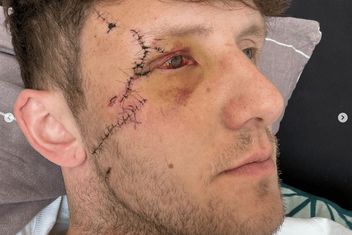 Ein Foto des Opfers: Die Schnittverletzungen stammen von einem zerbrochenen Longdrinkglas.