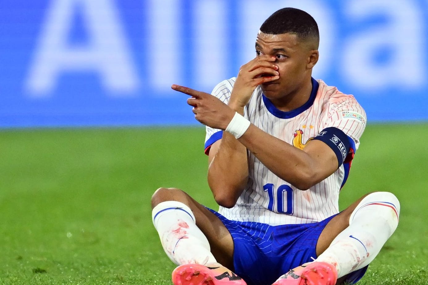 Kylian Mbappé: Frankreichs Topstar blutete nach einem Zusammenprall heftig aus der Nase.