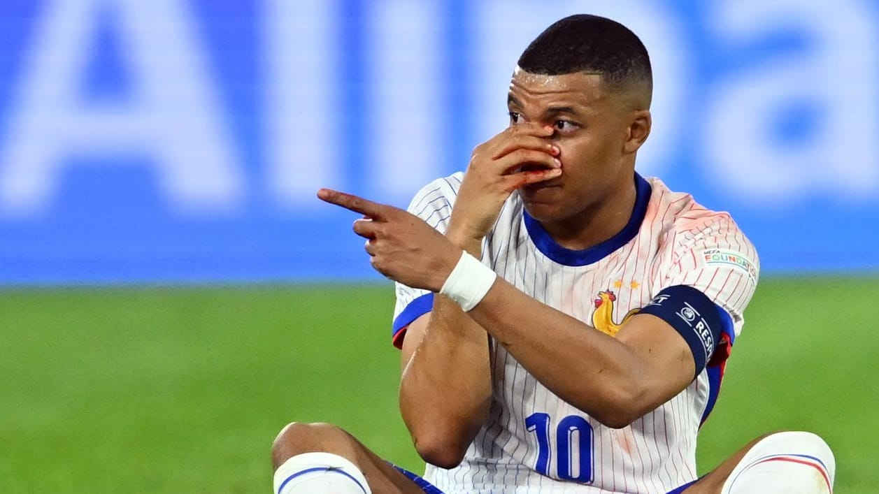 Kylian Mbappé: Frankreichs Topstar blutete nach einem Zusammenprall heftig aus der Nase.