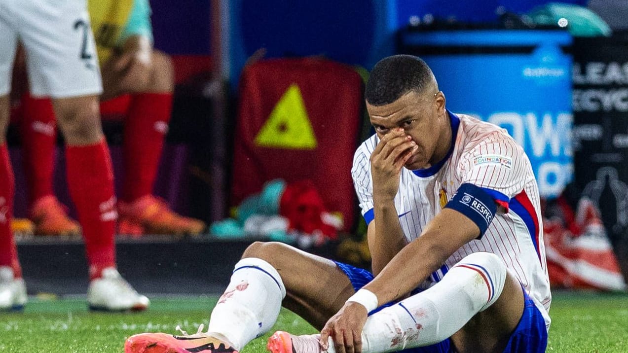 Kylian Mbappé: Er hat zuletzt einen Nasenbeinbruch erlitten.