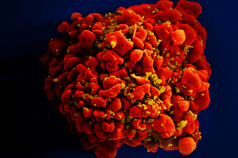 Kolorierte Aufnahme einer Immunzelle, die von HI-Viruspartikeln (in gelb) erfasst worden ist.