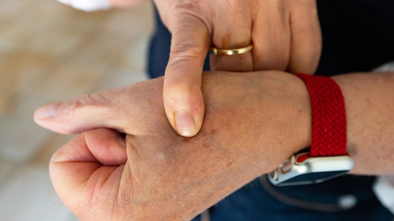 Frau trägt Chip im Handgelenk