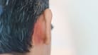Man having ear problems due to Seborrheic dermatitis, psoriasis, ringworm and fungal skin infection