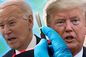 Facelift, Haartransplantation und Botox? Haben Joe Biden und Donald Trump nachgeholfen?