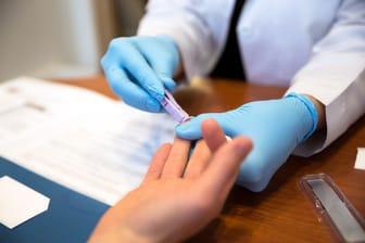 Bluttest: Weltweit leben rund 39 Millionen Menschen mit HIV-Infektionen.