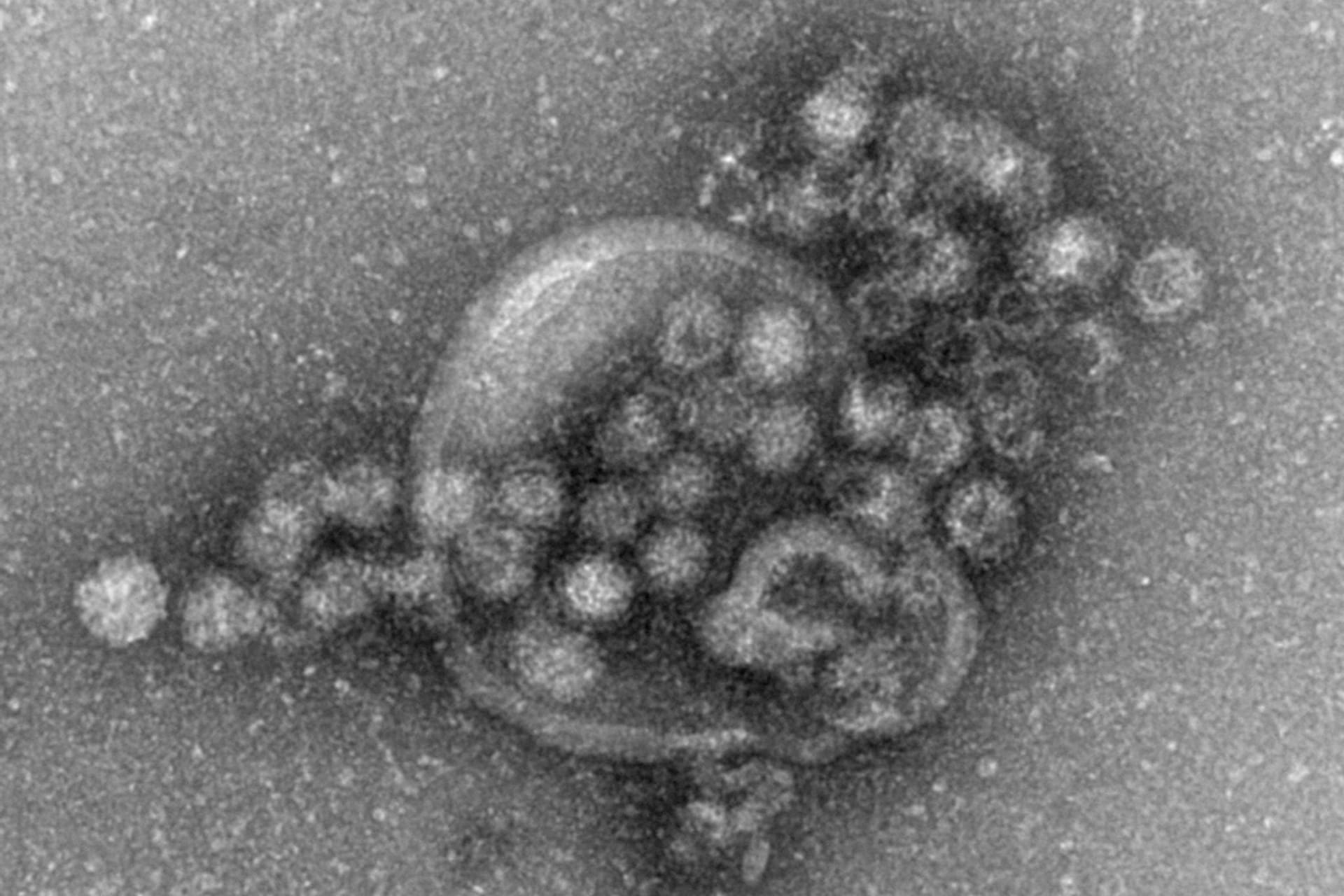 Norovirus