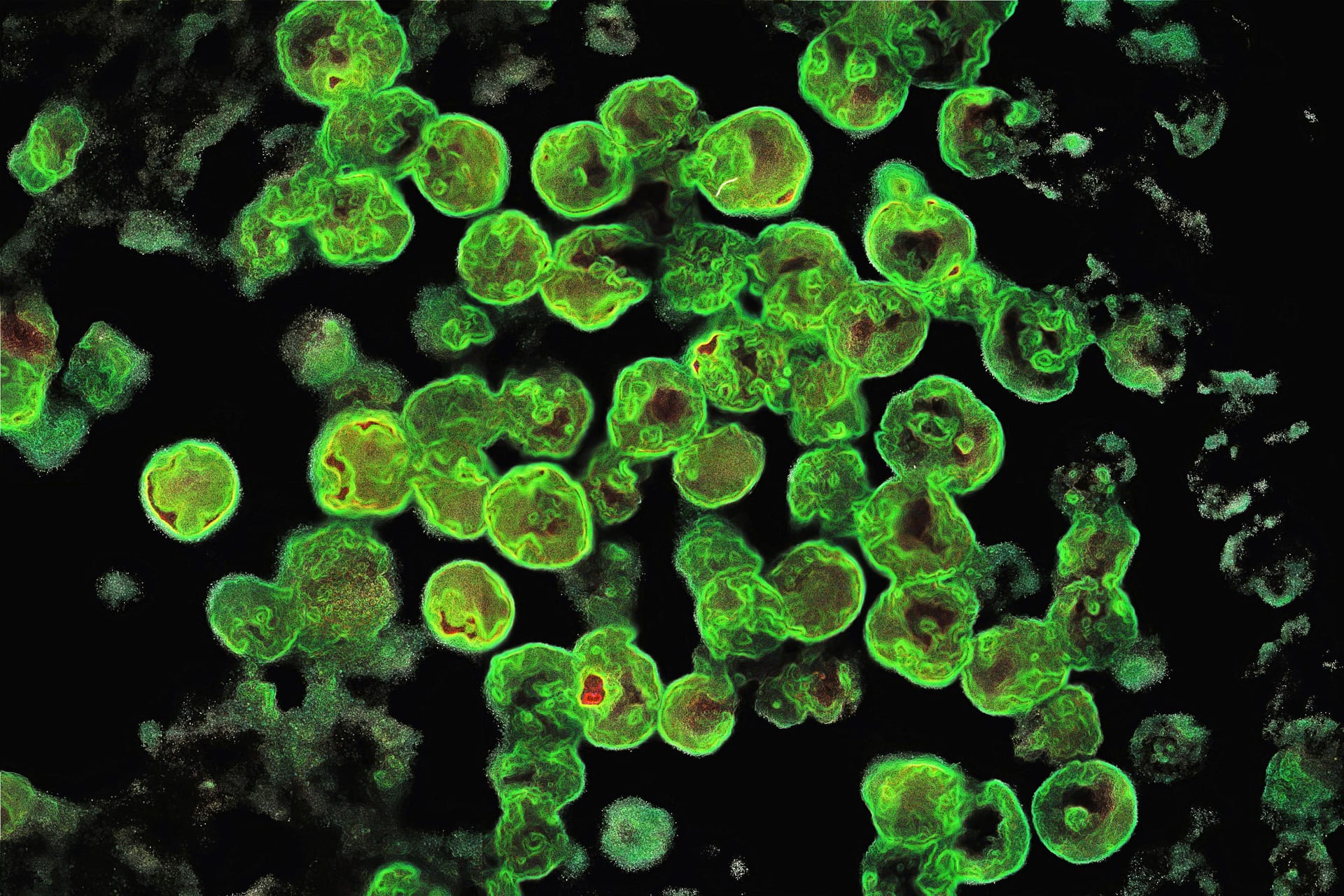 Die gehirnfressende Amöbe Naegleria fowleri.