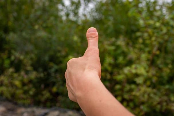 Brachydaktylie Typ D: Betroffene haben einen sichtbar verkürzten, verdickten Daumen.