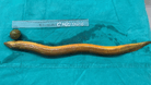 Der Aal: Neben ihm liegt eine Limette, die sich der Patient ebenfalls eingeführt hatte.