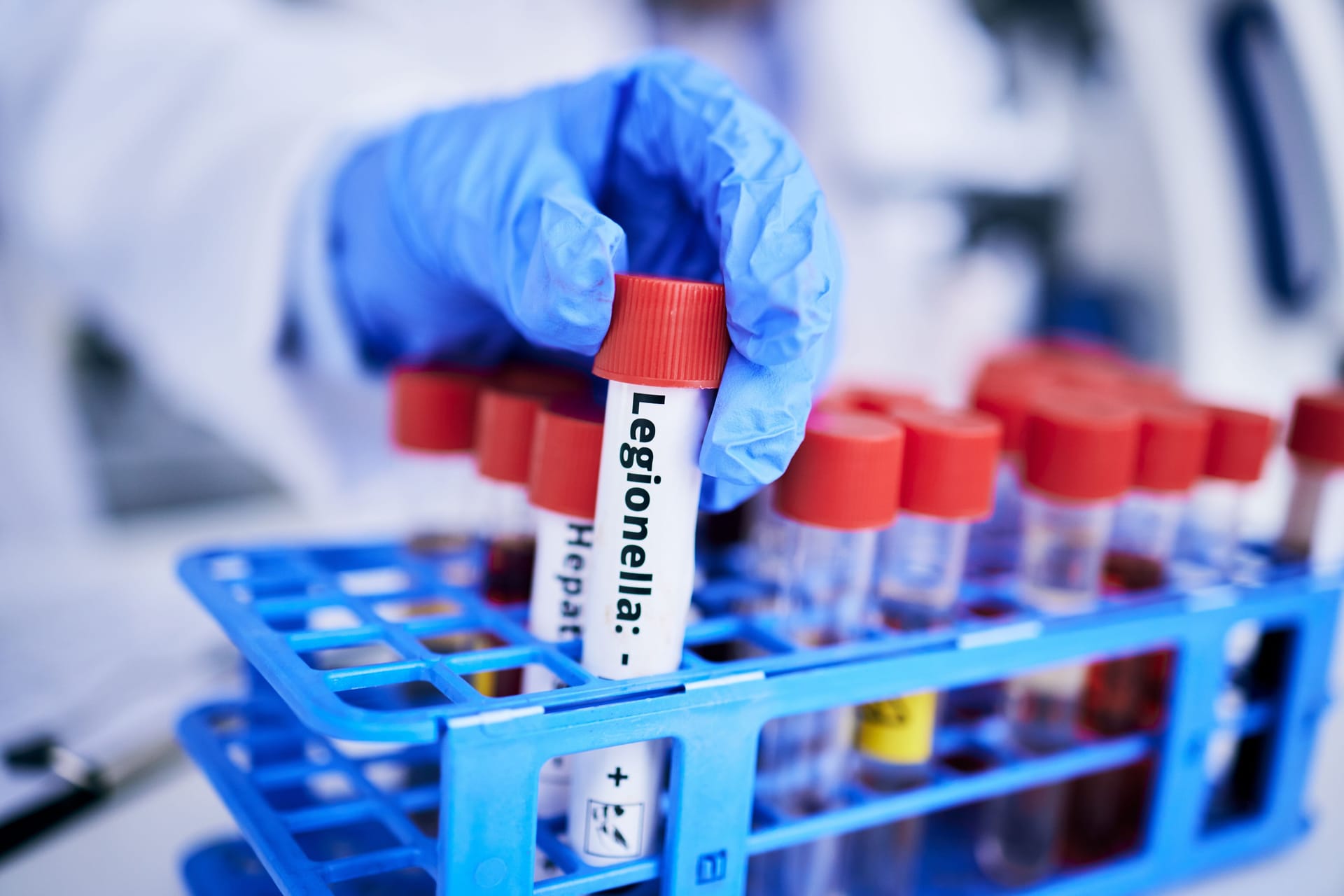 Scientist, hand and bacteria sample in test tube, person in lab with medical research and healthcare study. Doctor, gloves and vaccine, check legionella sample closeup and scientific experiment