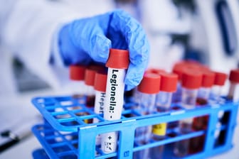 Scientist, hand and bacteria sample in test tube, person in lab with medical research and healthcare study. Doctor, gloves and vaccine, check legionella sample closeup and scientific experiment