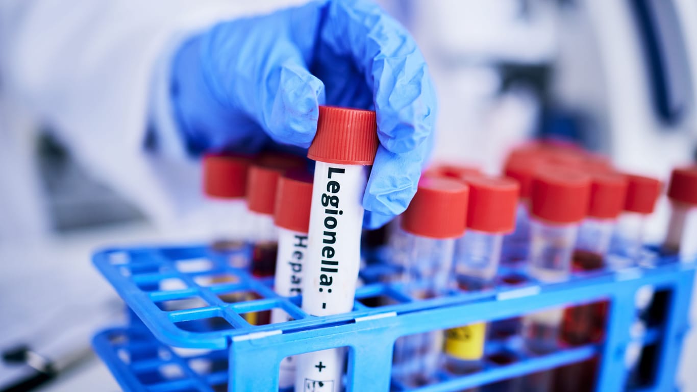 Scientist, hand and bacteria sample in test tube, person in lab with medical research and healthcare study. Doctor, gloves and vaccine, check legionella sample closeup and scientific experiment