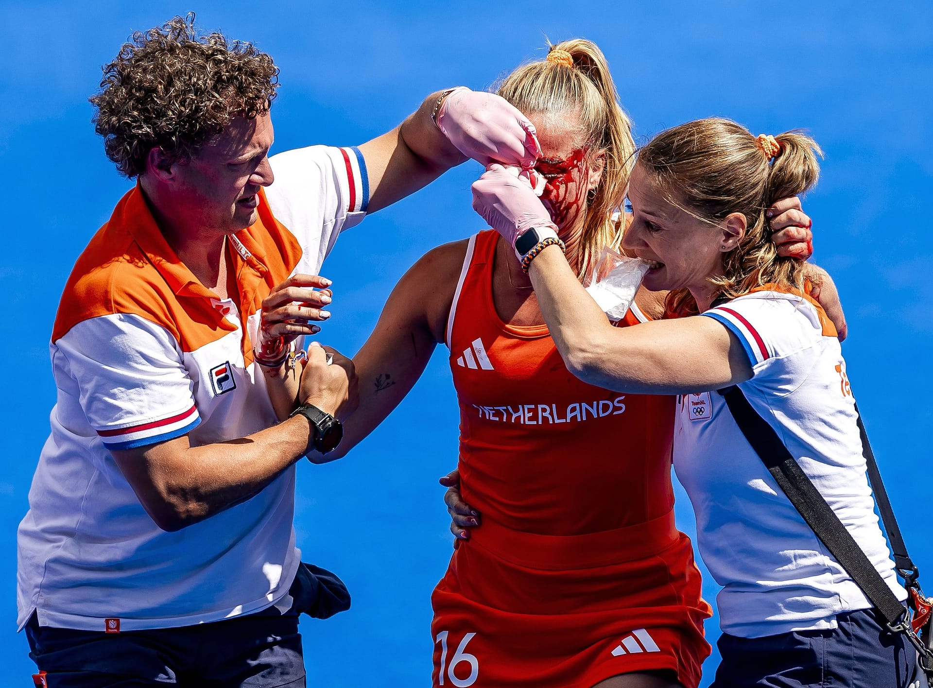 Die niederländische Joosje Burg (M.) wurde im Hockey-Halbfinale der Frauen gegen Argentinien vom Ball im Gesicht getroffen. Nach einer kurzen Unterbrechung zog sie sich ein neues Trikot über und spielte mit einem abgeklebten Cut und einem Tampon in der Nase weiter.