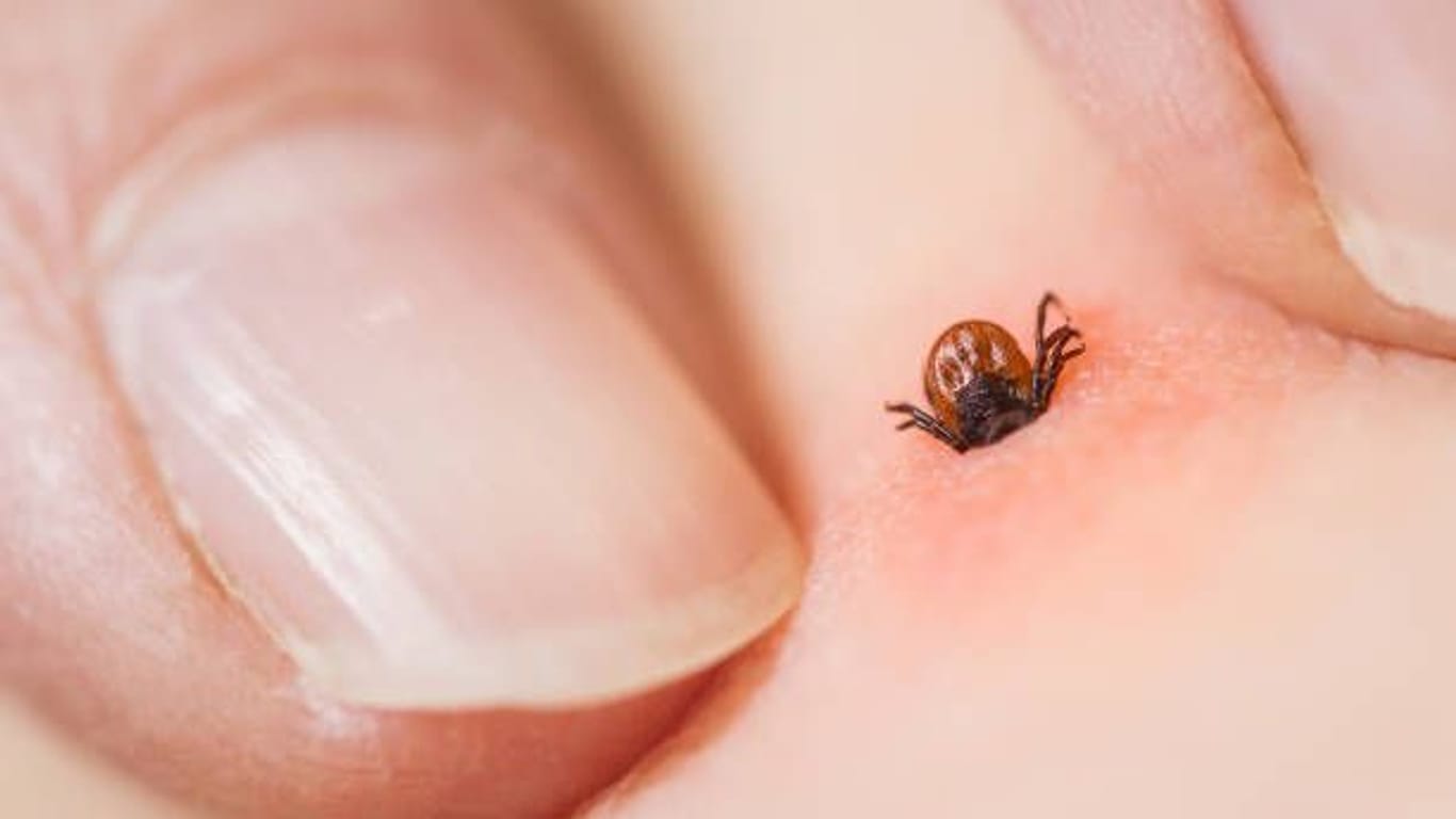 Zeckenstich: Er äußert sich meist durch eine gerötete, kreisförmige Stelle auf der Haut.