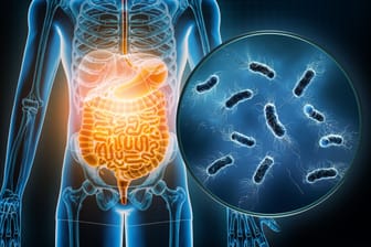 Bakterielle Infektionen des Magen-Darm-Traktes: Oft sind E. coli die Auslöser.