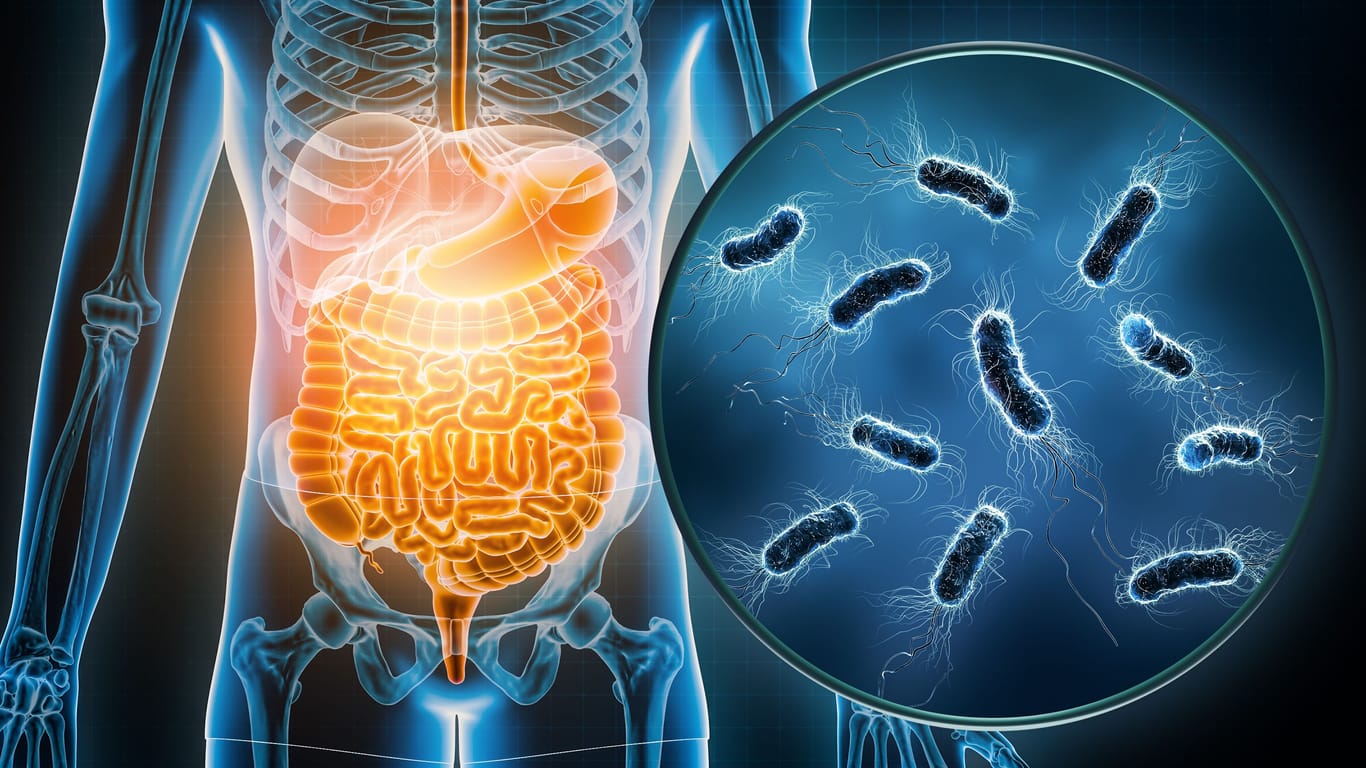 Bakterielle Infektionen des Magen-Darm-Traktes: Oft sind E. coli die Auslöser.