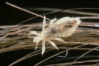 Parasiten: Kopfläuse können zu allen Jahreszeiten gehäuft auftreten, in den kühleren verbreiten sie sich meist besonders schnell.