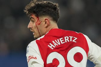 Gezeichnet: Kai Havetz im Spiel beim FC Chelsea.