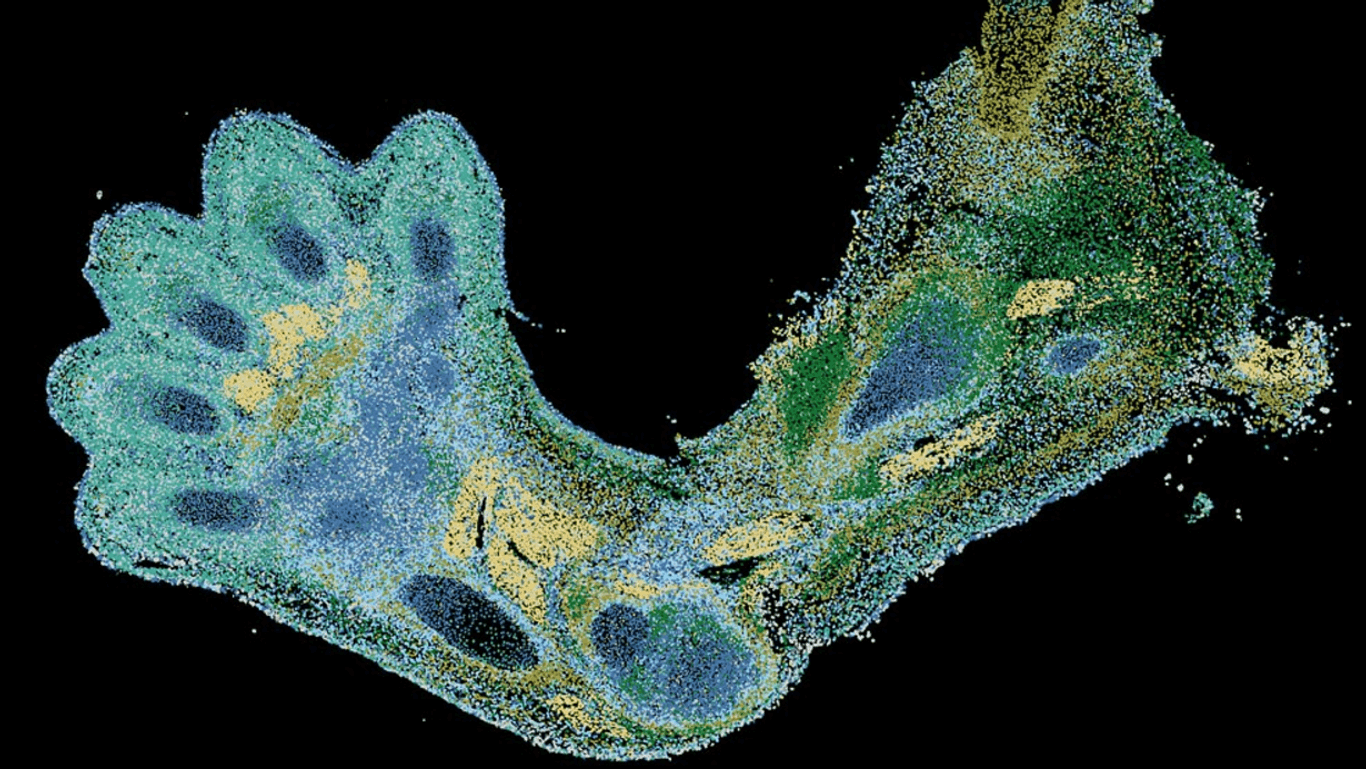 Arm eines Embryos: Zunächst entstehen dort Knorpelzellen, später Knochen.