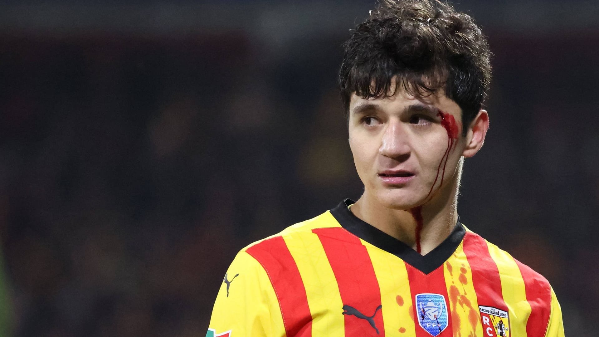 Abdukodir Khusanov: Er spielt seit Sommer 2023 beim RC Lens, hat bsich kürzlich eine Wunde zugezogen.