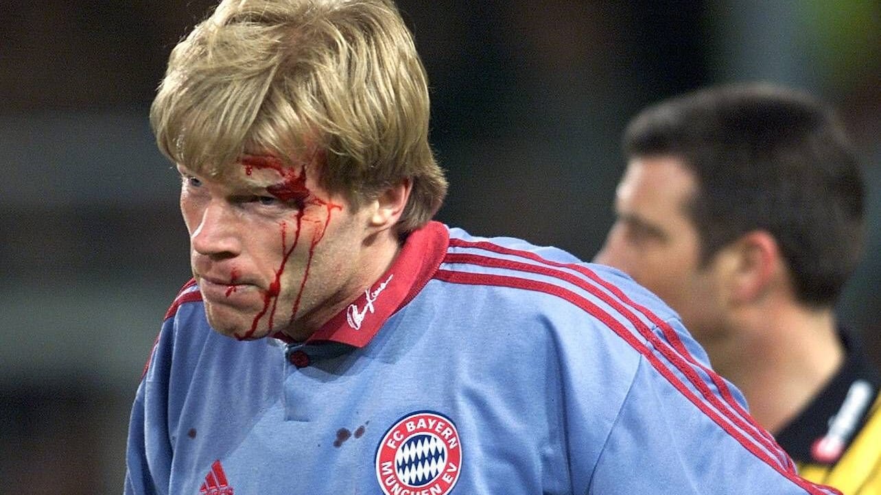 Oliver Kahn im Jahr 2000: Er wurde von einem Golfball getroffen.