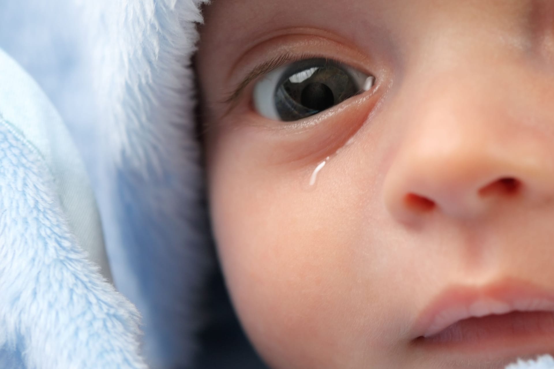 Baby mit tränendem Auge: Tränen die Augen beim Baby oder Kleinkind ständig, ist womöglich eine angeborene Tränenwegsstenose die Ursache.