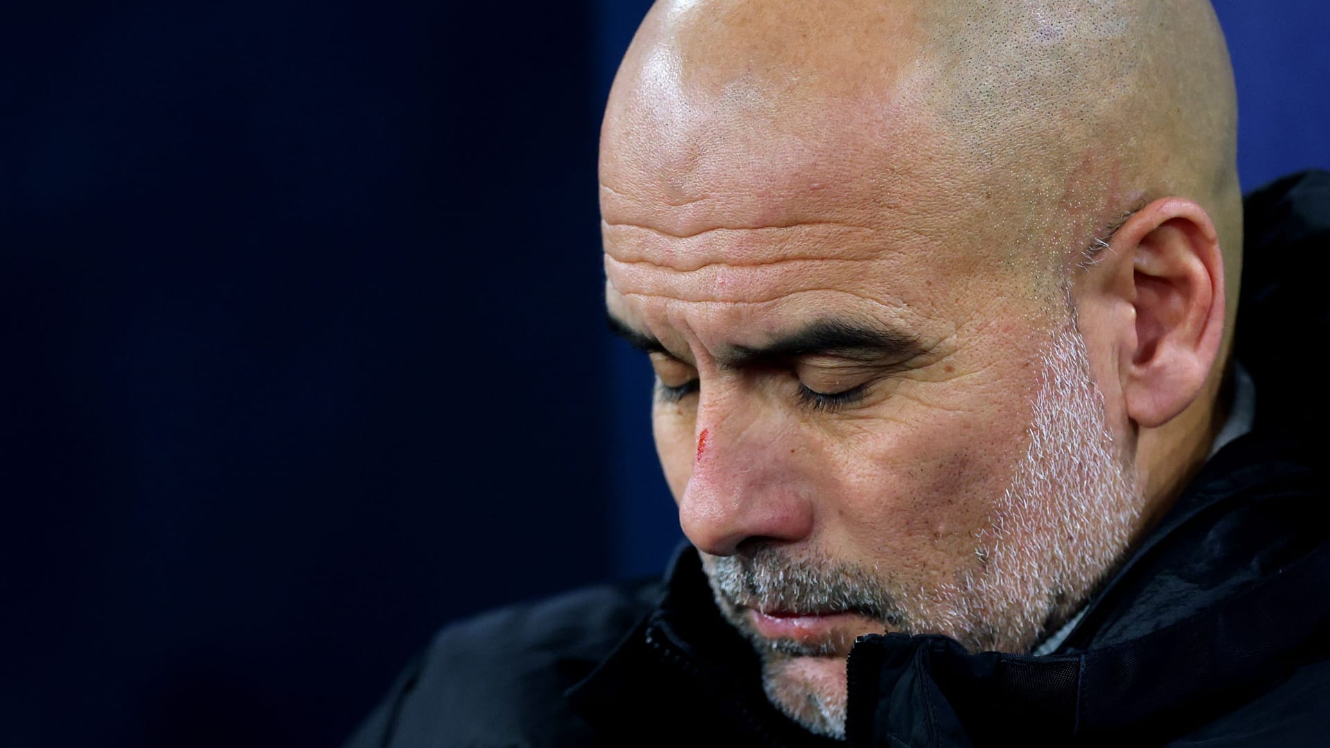 Blutige Nase: Beim Spiel gegen Feyenoord verletzte sich Pep Guardiola selbst.