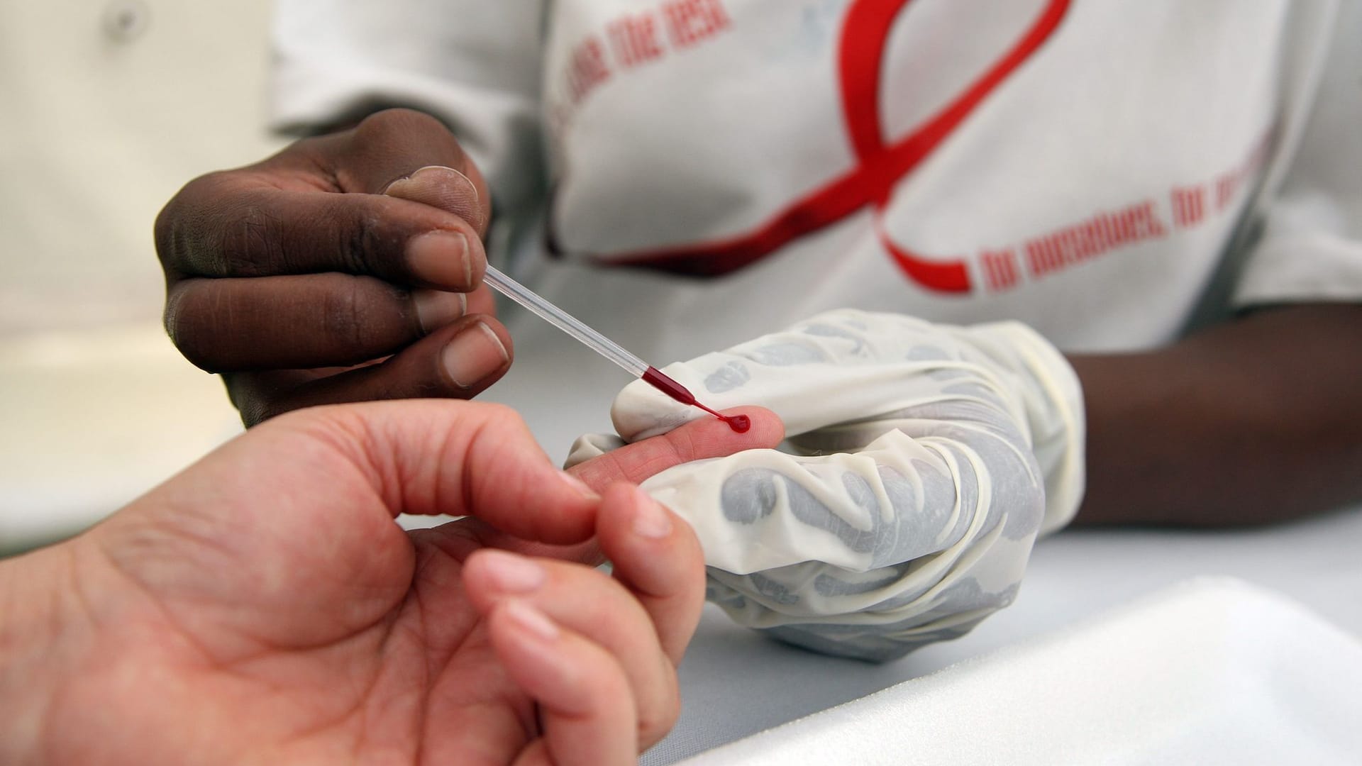 Blutabnahme für HIV-Test in Südafrika