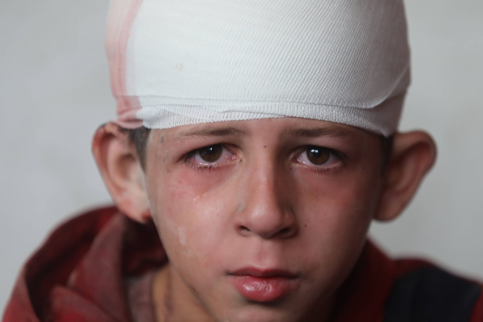 Ein durch einen israelischen Militärschlag verletzter palästinensischer Junge.