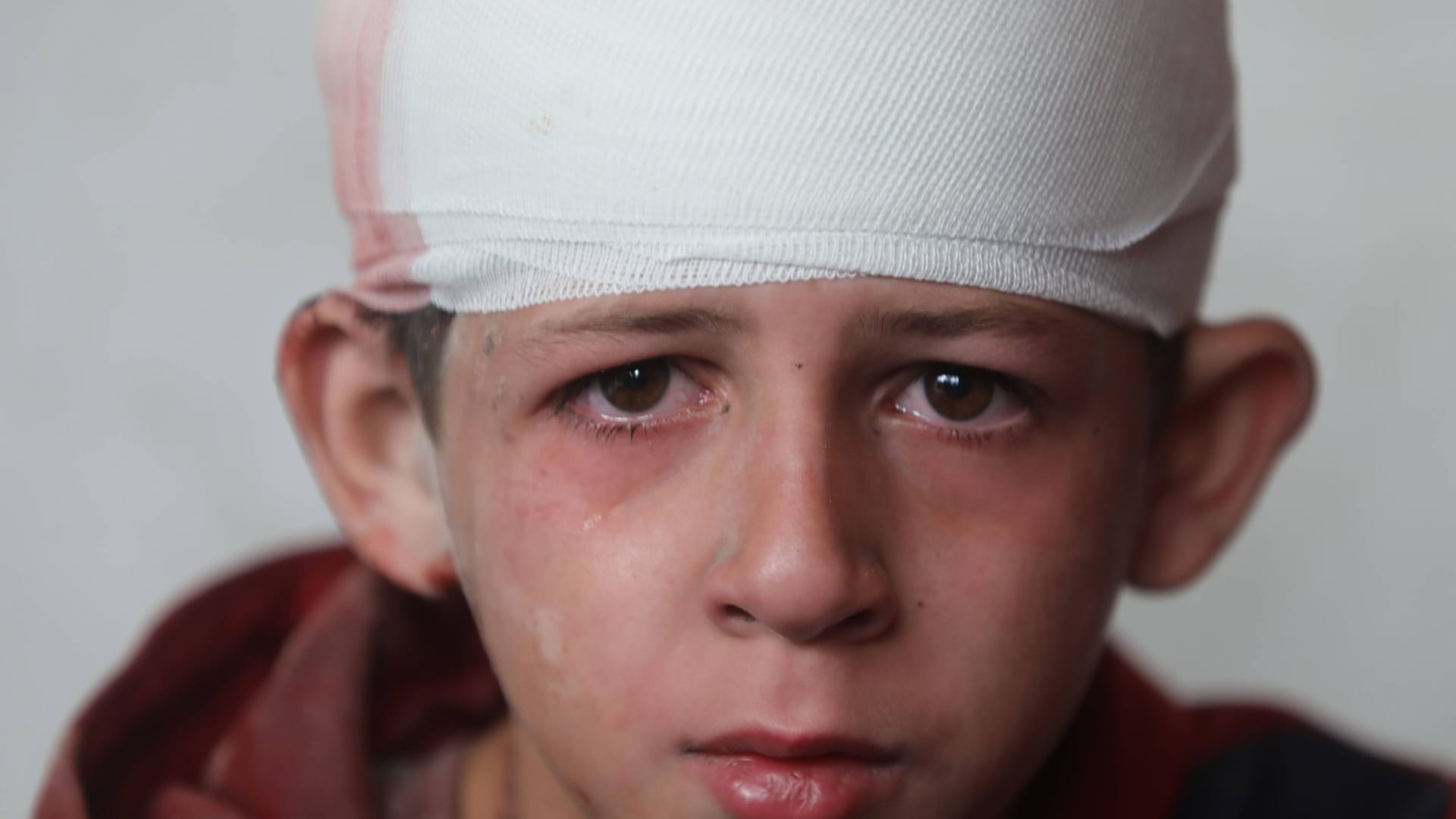 Ein durch einen israelischen Militärschlag verletzter palästinensischer Junge. Ein durch einen israelischen Militärschlag verletzter palästinensischer Junge.