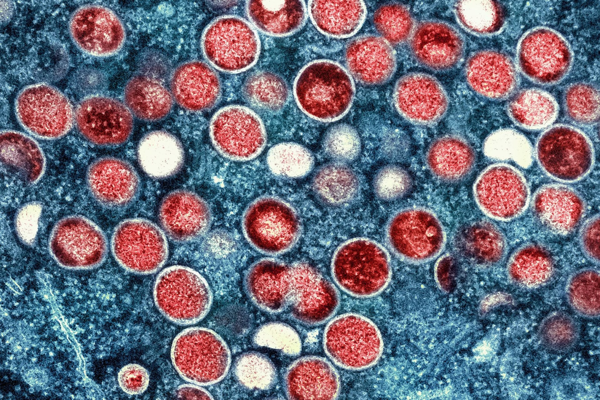 Mikroskopaufnahme von Mpox-Partikeln (rot) in einer infizierten Zelle (blau): Das Virus wird vor allem durch engen körperlichen Kontakt übertragen.
